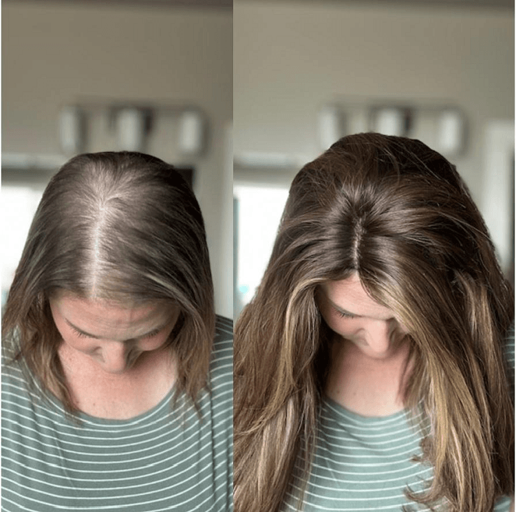 Hair Toppers for Thinning Hair