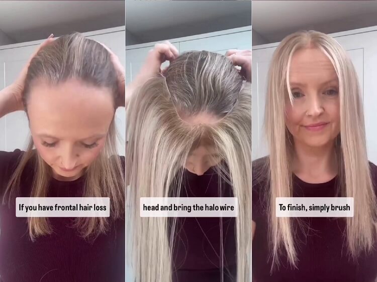 hairline topper before and after results